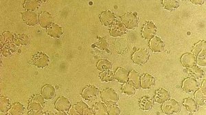 Почему всегда хочется спать и нет сил Причина под носом!