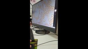 Почему организм не справляется с болезнями