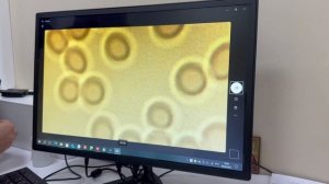 Растирания для здоровья и сильного иммунитета!