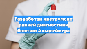 Разработан инструмент ранней диагностики болезни Альцгеймера
