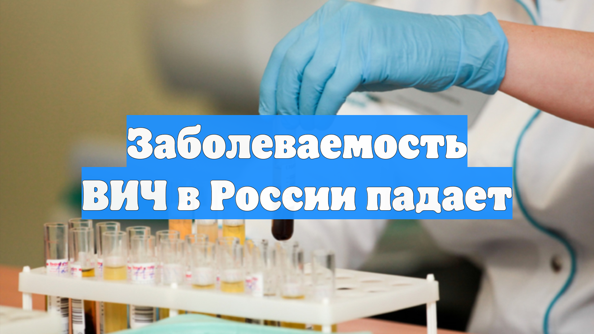 Заболеваемость ВИЧ в России падает