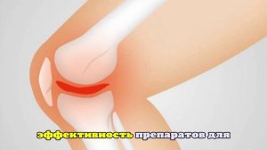 Умный гель чувствует обострение артрита, снижая боль
