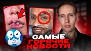 Люди Могут Менять  Цвет Глаз...Уменьшение Губ Новый Тренд У Девушек...