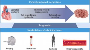 Сердечная недостаточность, приводящая к раку: современные знания в двунаправленной кардиоонкологии