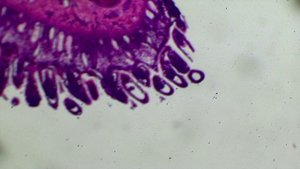 Срез тонкой кишки под микроскопом