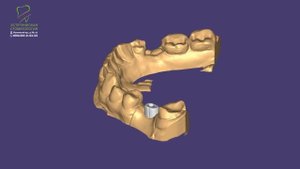 Современные возможности цифровой стоматологии в клинике Эстетической стоматологии Эсто .mp4