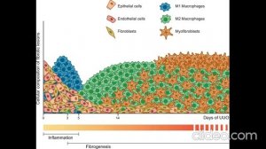 Обструктивная нефропатия и молекулярная патофизиология интерстициального фиброза почек
