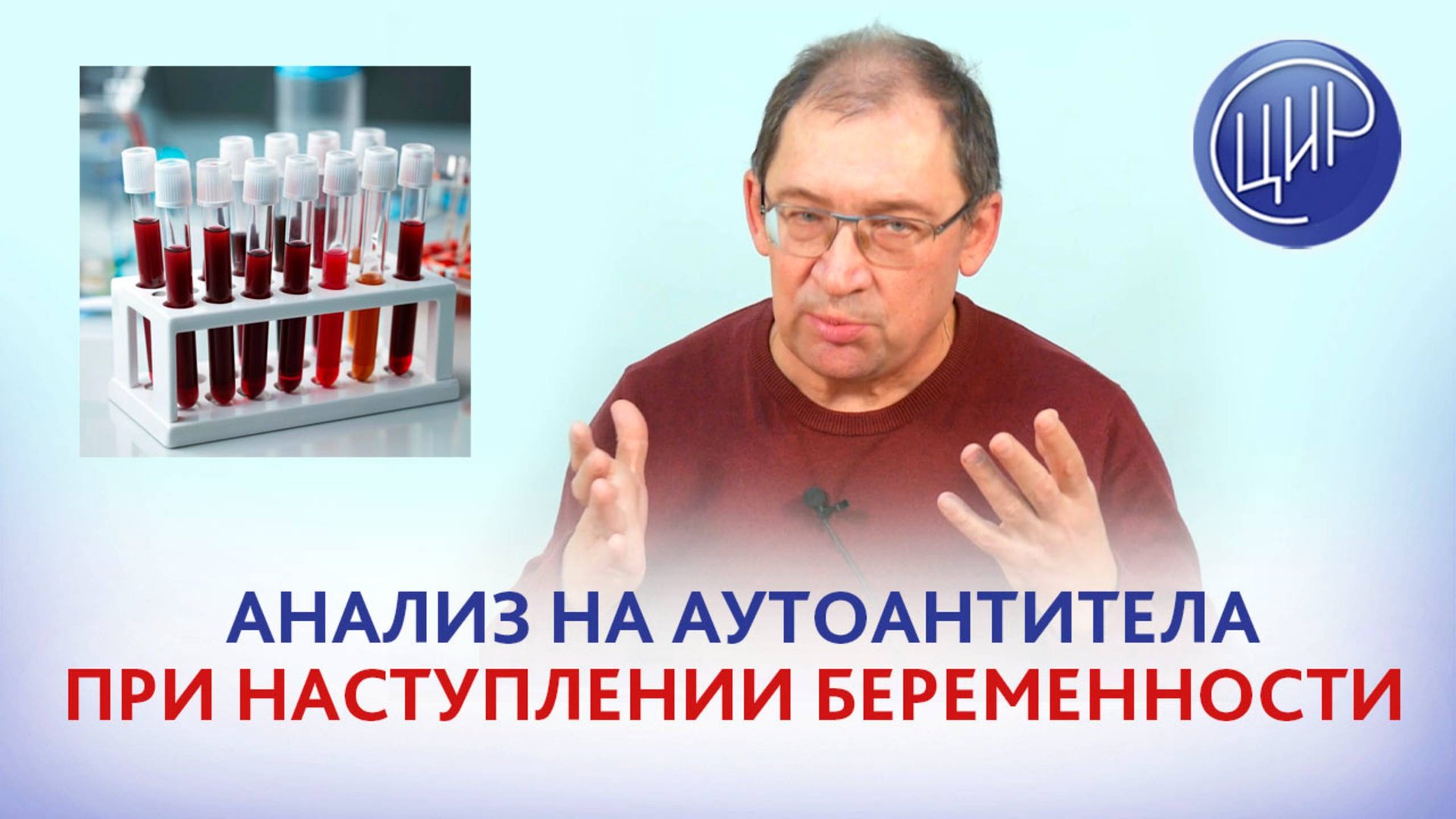 Почему надо делать анализ на аутоантитела при наступлении беременности. К.м.н. Игорь Иванович Гузов.