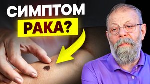 💡 Способ заметить опухоль задолго до онкомаркёров и биопсии