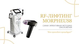 MORPHEUS 8 МИКРОИГОЛЬЧАТЫЙ RF-ЛИФТИНГ | Клиника молодости ТЭСТА