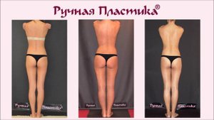 Ручная Пластика тела.  500 фото ДО и ПОСЛЕ. Центр  Ручная Пластика.