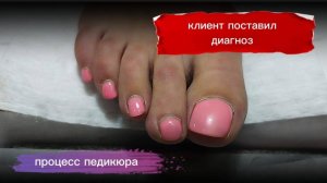 Клиент поставил диагноз 🫣😆 #маникюр #педикюр #жуковский #ногти #наращиваниеногтей #маникюрмосква