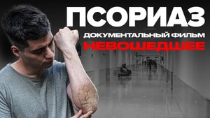 Псориаз | Невошедшее