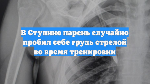 В Ступино парень случайно пробил себе грудь стрелой во время тренировки
