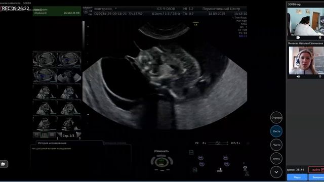 Чехонацкая МЛ, Яннаева Н.Е. Гигрома шеи плода