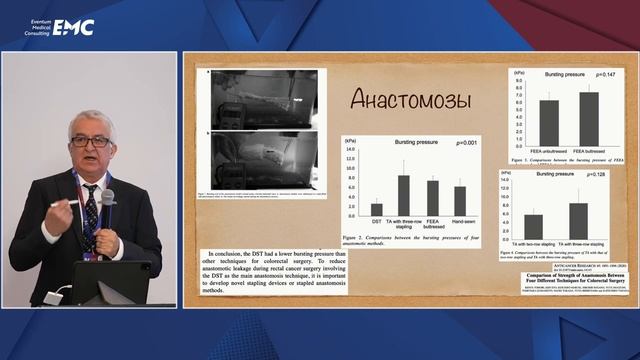 Доклад «Дигестивные анастомозы» Егиев В.Н.