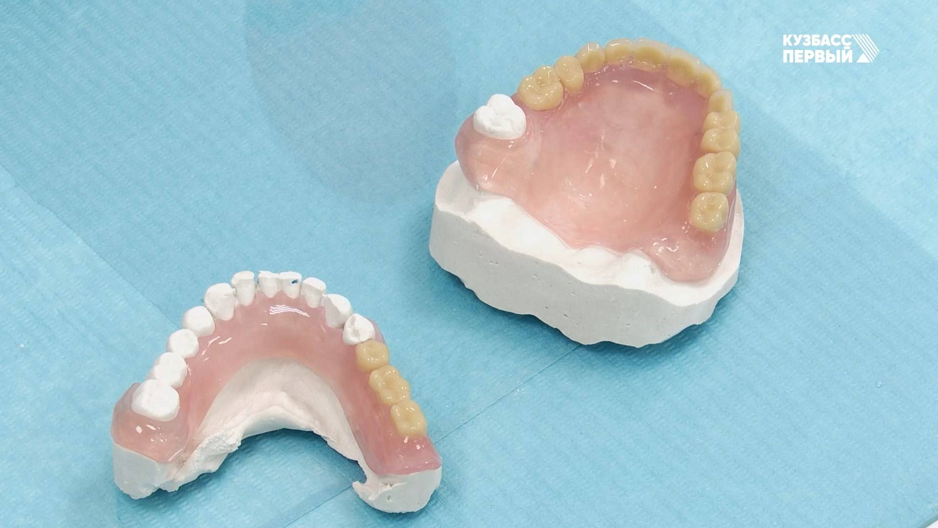 Здоровая улыбка России. Какие симптомы у пародонтита и в чем преимущество импланта над протезом?