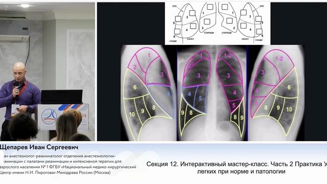 Практика УЗИ легких при норме и патологии (М-класс) Щепарев И.С.