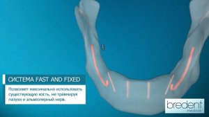 fast & fixed – здоровье всего организма начинается во рту