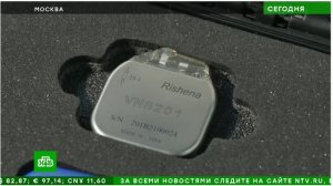 "Высокотехнологичное нейромодуляционное лечение в нейрохирургическом отделении нашего центра"