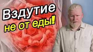Вздутие не от еды! 4 скрытые причины, о которых молчат врачи. готовый выпуск