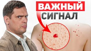 Не игнорируй КРАСНЫЕ точки на теле. Это признак проблем с...