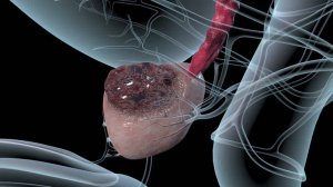 САМЫЙ ПОЗНАВАТЕЛЬНЫЙ КАНАЛ. ВСЁ О РАКЕ ПРОСТАТЫ.