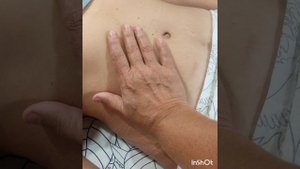 Профилактика Бышихи