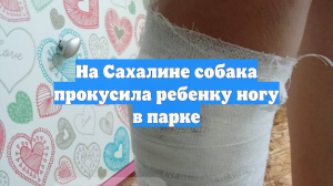 На Сахалине собака прокусила ребенку ногу в парке