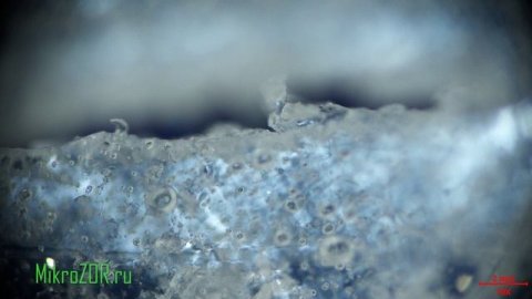 Под микроскопом