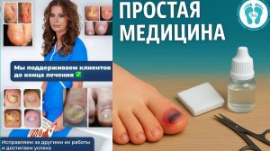 Пальцы целуются