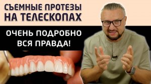 Показываем съемные зубные протезы Кандулор на телескопах, а так же процесс их установки пациенту.