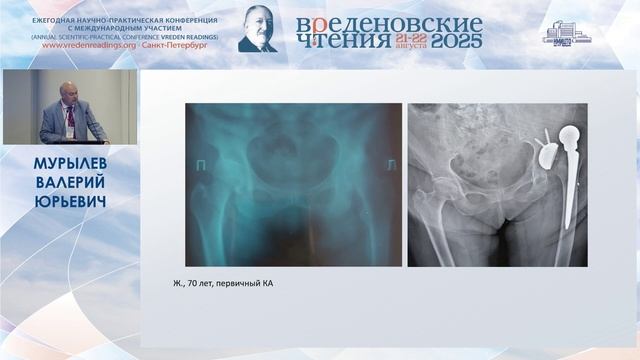 «Вреденовские чтения» 22.08.2025 - Зал B6-8