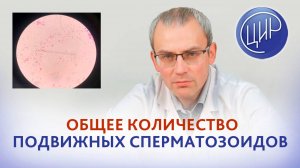 Общее количество подвижных сперматозоидов. Круглые клетки и лейкоциты в эякуляте.