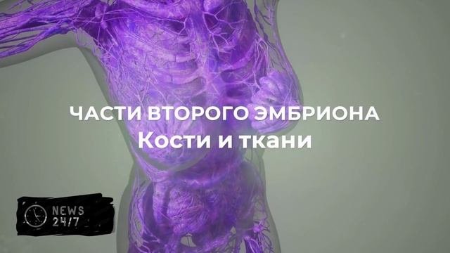 Ребенок с братом-близнецом в животе родился в Индии