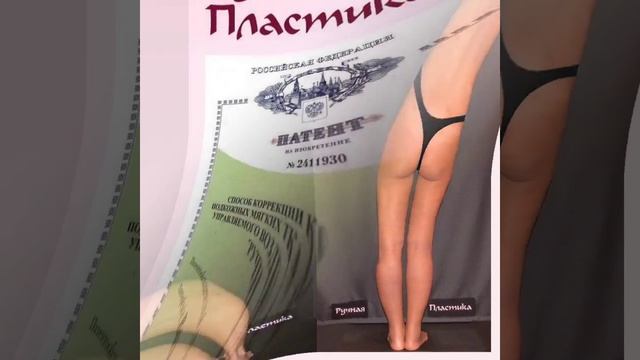 Липосакция без операции. Центр Ручная Пластика® . Патент. 500 фото. ruchnaya-plastika.ru