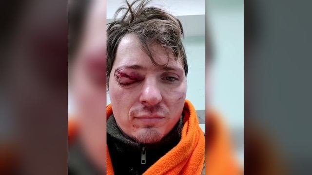 #Охота #Фейлы Сказ о том как поляк на оленя ходил.