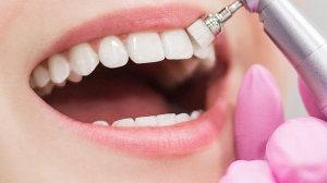 СТОМАТОЛОГИЯ «ПЛАНЕТА» — ВАШ НАДЕЖНЫЙ ПАРТНЕР В ЗДОРОВОЙ УЛЫБКЕ! ✨