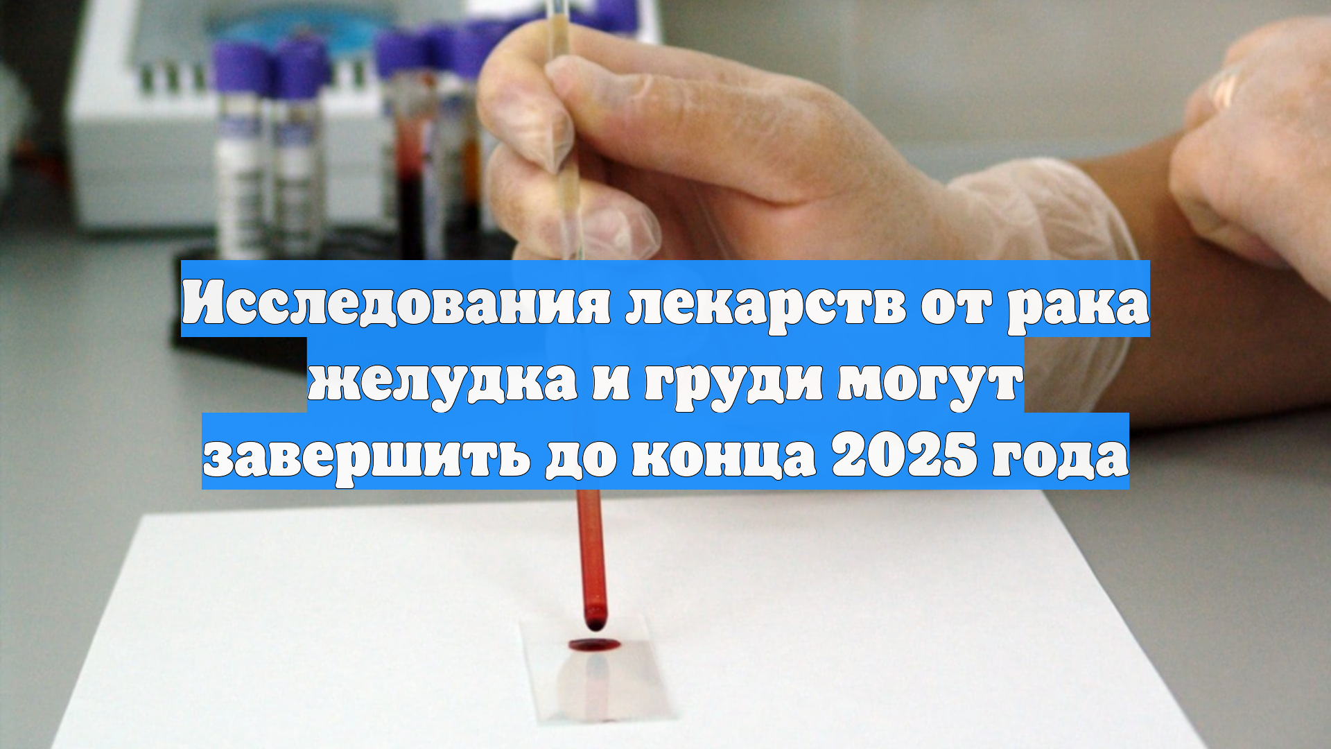 Исследования лекарств от рака желудка и груди могут завершить до конца 2025 года