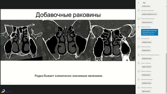 Лучевая Анатомия придаточных пазух носа 1