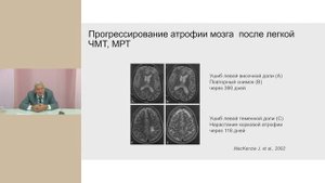 Больной, перенесший черепно-мозговую травму, на амбулаторном приеме