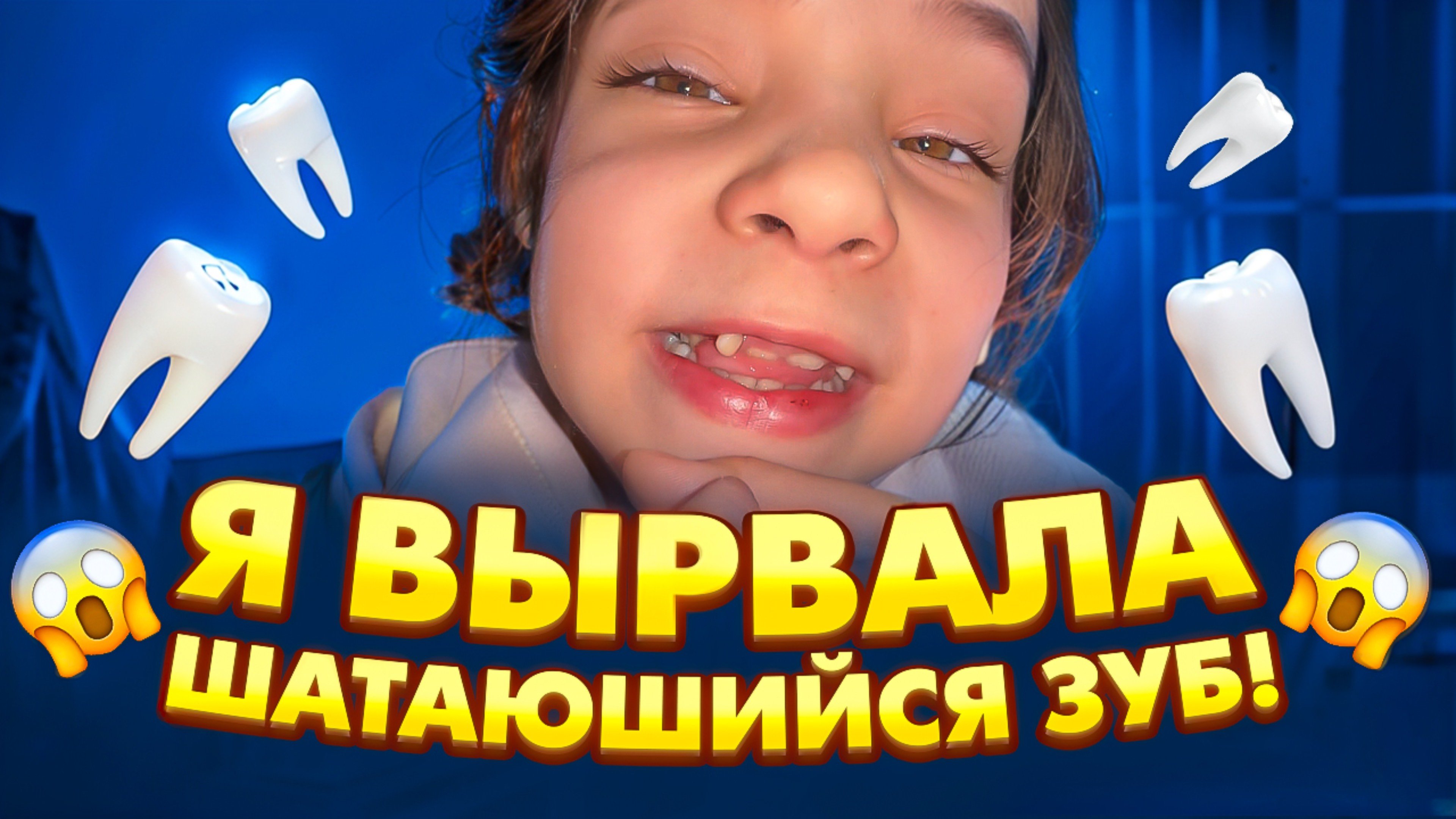 Милена вырвала свой шатающийся зуб🤭