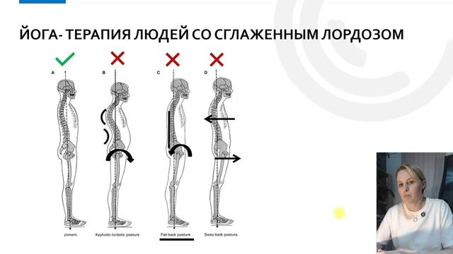 Стартовый модуль курса по йога-терапии