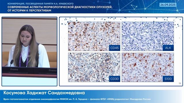 Лимфопролиферативные поражения кожи - Косумова Х.С.