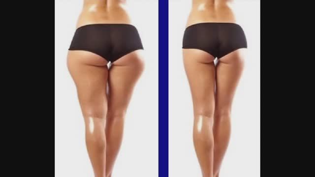 NEWBODYKA – РУЧНАЯ ПЛАСТИКА ТЕЛА И ЛИЦА. КОРРЕКЦИЯ ФИГУРЫ.