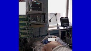 ОРДС: что нового?