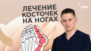 Косточки на ногах у большого пальца и деформация пальцев стопы