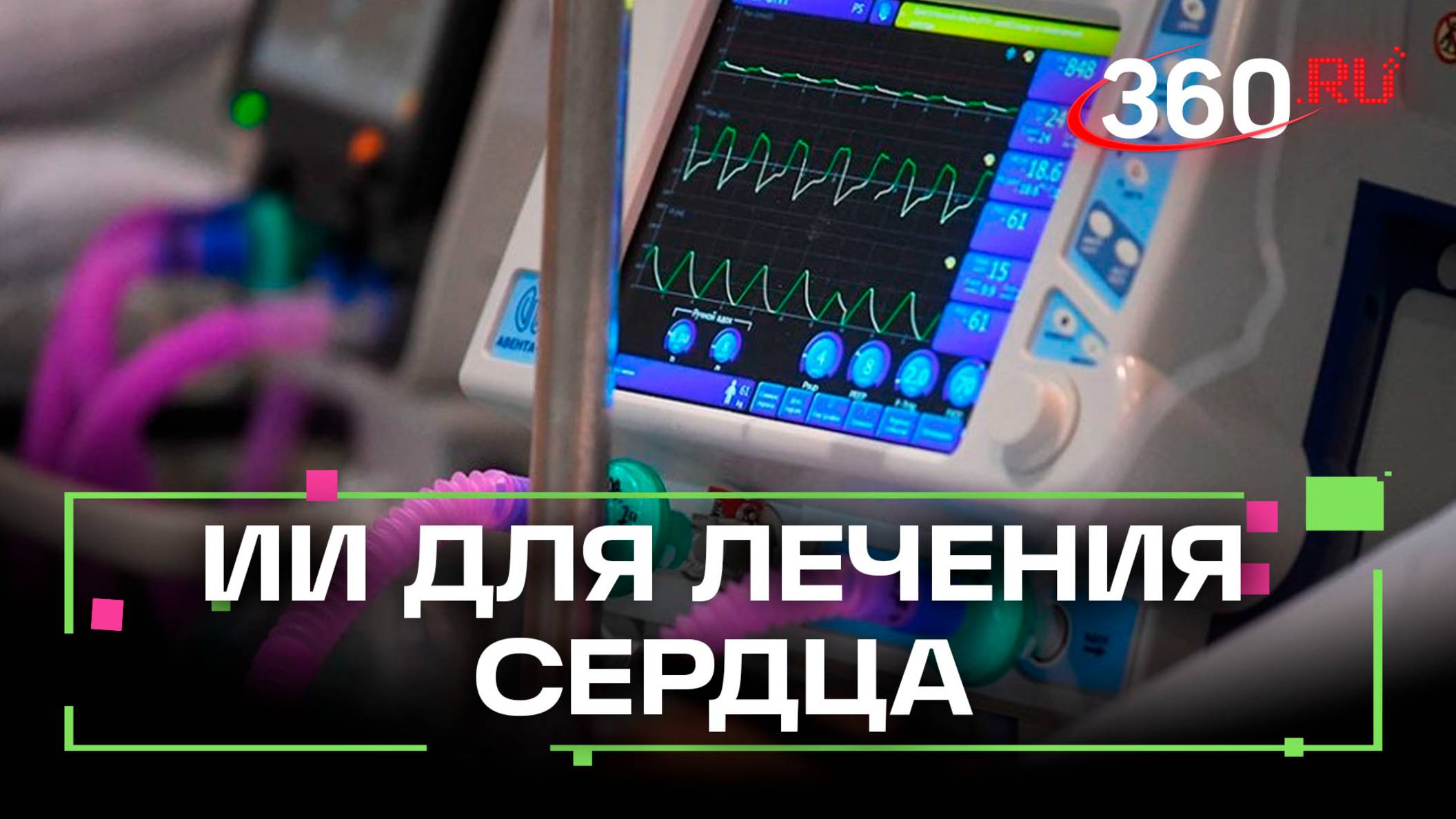 Нейросеть вместо врача: как кардиолог из Мытищ прогнозирует равзитие аритмии