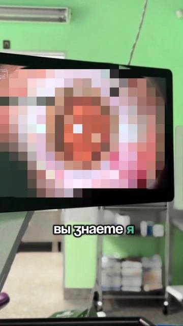 Смотрите видео-отзыв пациентки после операции по удалению катаракты.