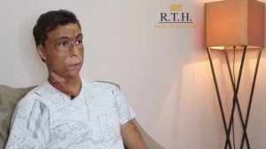 Пересадка волос и бровей пациенту с ожогами!